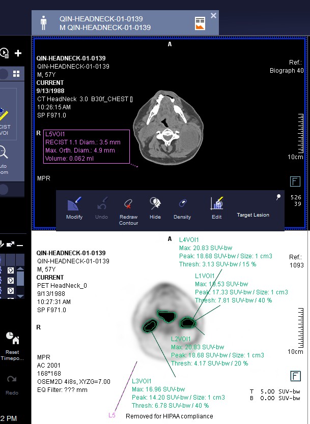 Software de endoscopía Hauss EndoCapture: captura en vivo y generación de informe PDF