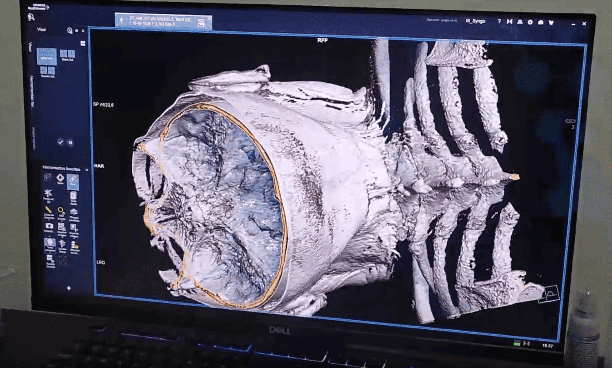 Video Mantención - Vista previa